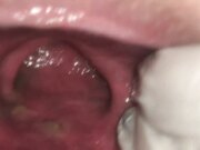 口味较重一骚妇勿进黑诊所被裸体水管冲到尿失禁趴开屁眼大肠头看到了