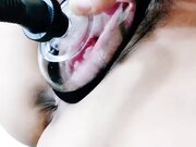 兄弟们快来看 肥逼大屁股随便玩 给逼逼拔罐子把她逼逼吸肿 道具插进逼逼看子宫