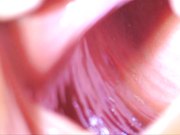 扒开女人阴道近距离用手电照明观看阴道内壁